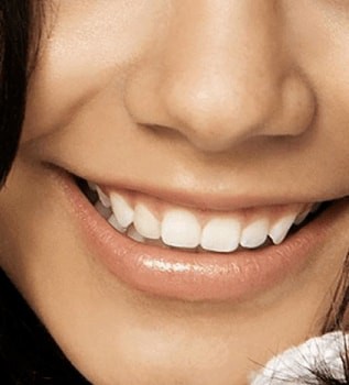 What is Preventive Dentistry