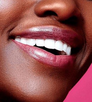 Restorative Dentistry, Fillings